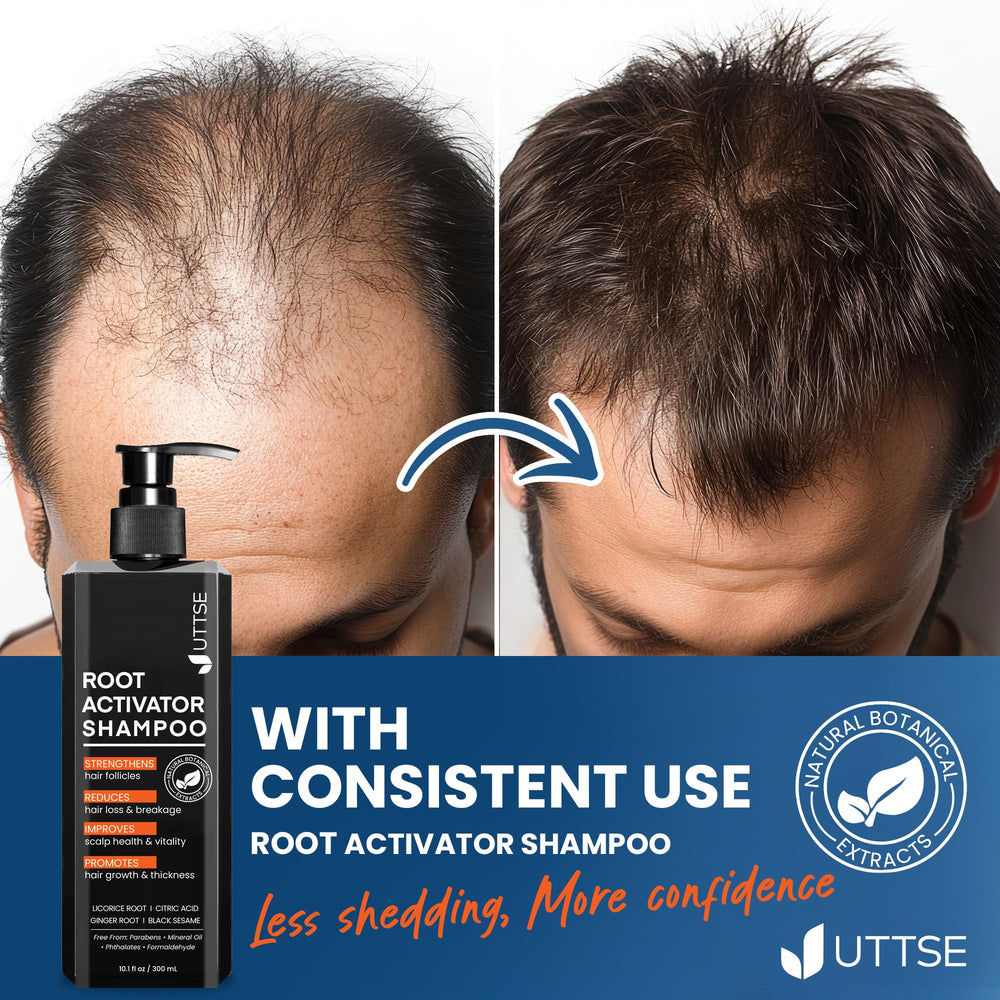 Uttse Root Activator Shampoo packaging highlights hair growth support through plant extracts.