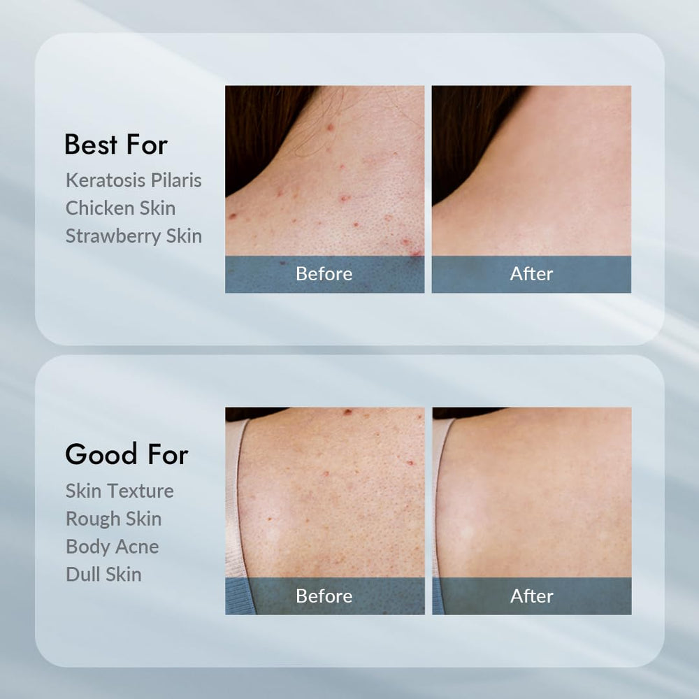 VILLAGE11FACTORY-rosemary-squalane nourishing skin barrier protection.