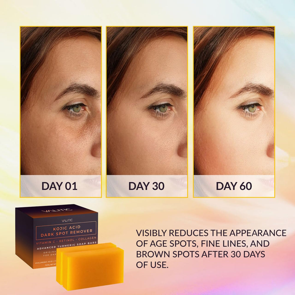 Valitic Kojic Acid soap bar close-up showing smooth texture and key ingredients.