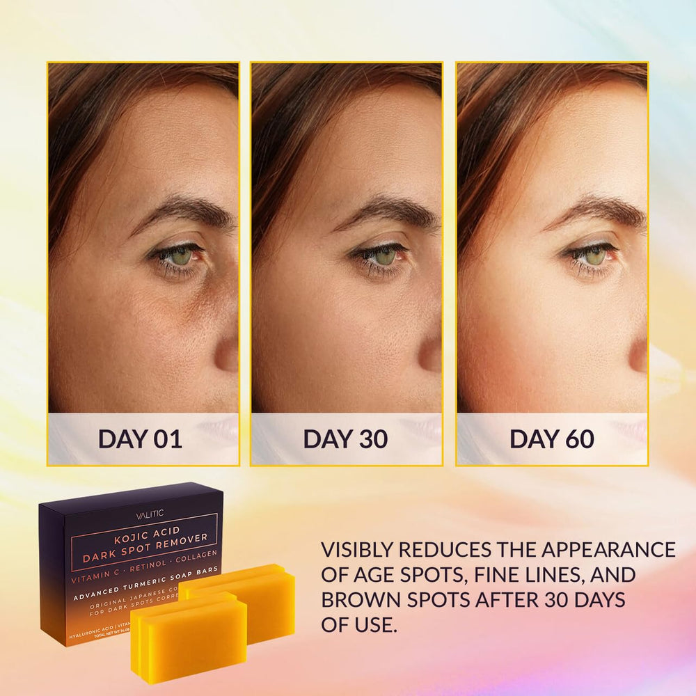 Valitic Kojic Acid Soap Bar foamy lather promoting even tone