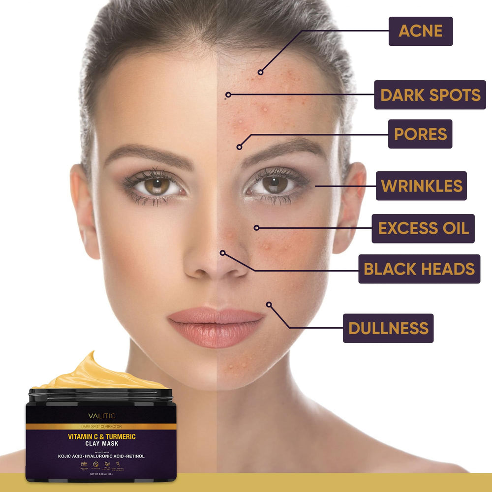 VALITIC Kojic Hyaluronic Retinol blend highlights hydration and renewal potential.