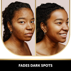 VALITIC Kojic Soap turmeric swirl hints at brightness and microcirculation support