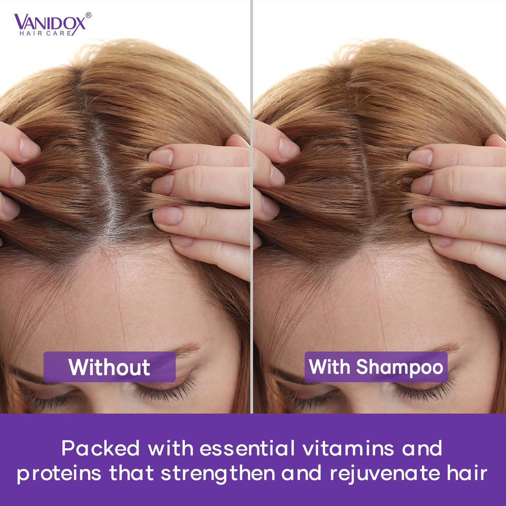 Vanidox Sulfate-Free label highlights gentle cleansing formula.