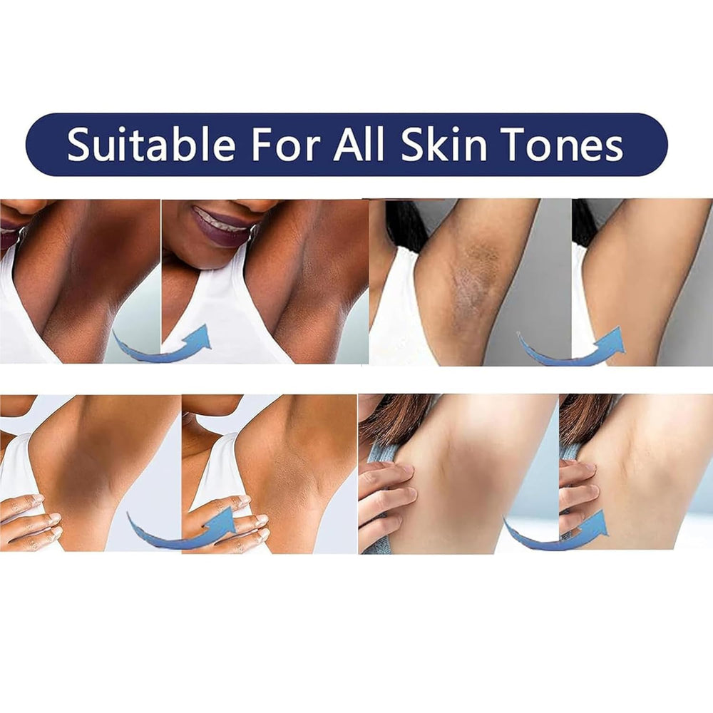 VCETree knees-elbows-brightening highlights improved radiance on rough joints.