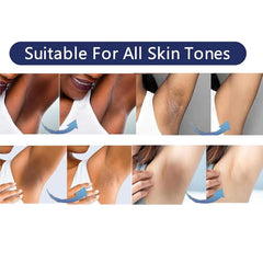 VCETree knees-elbows-brightening highlights improved radiance on rough joints.