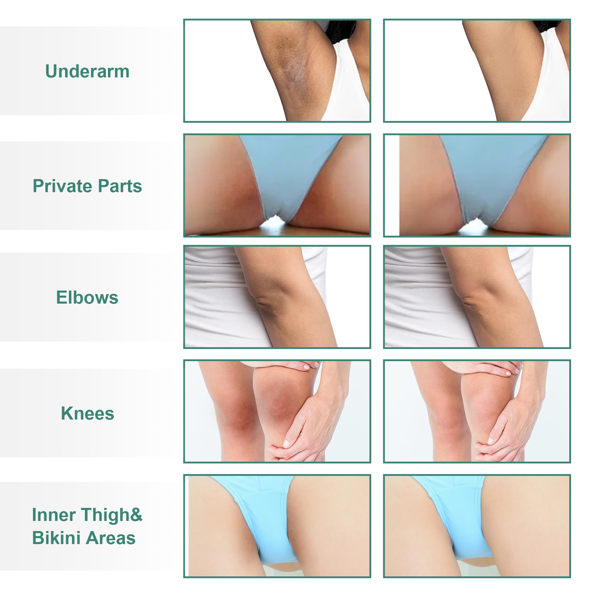 VCETree underarm-lightening-cream demonstrates targeted lightening with vitamin E.