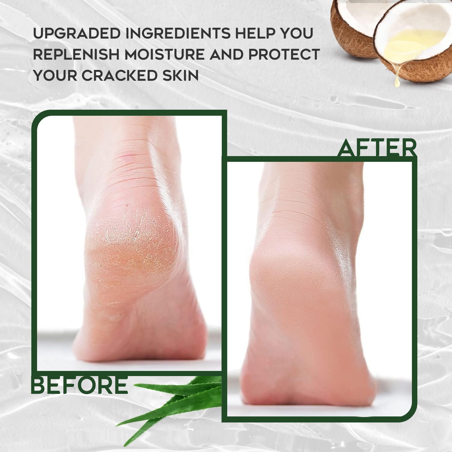 Vebuni Urea Cream elbows and knees application targets thickened skin.