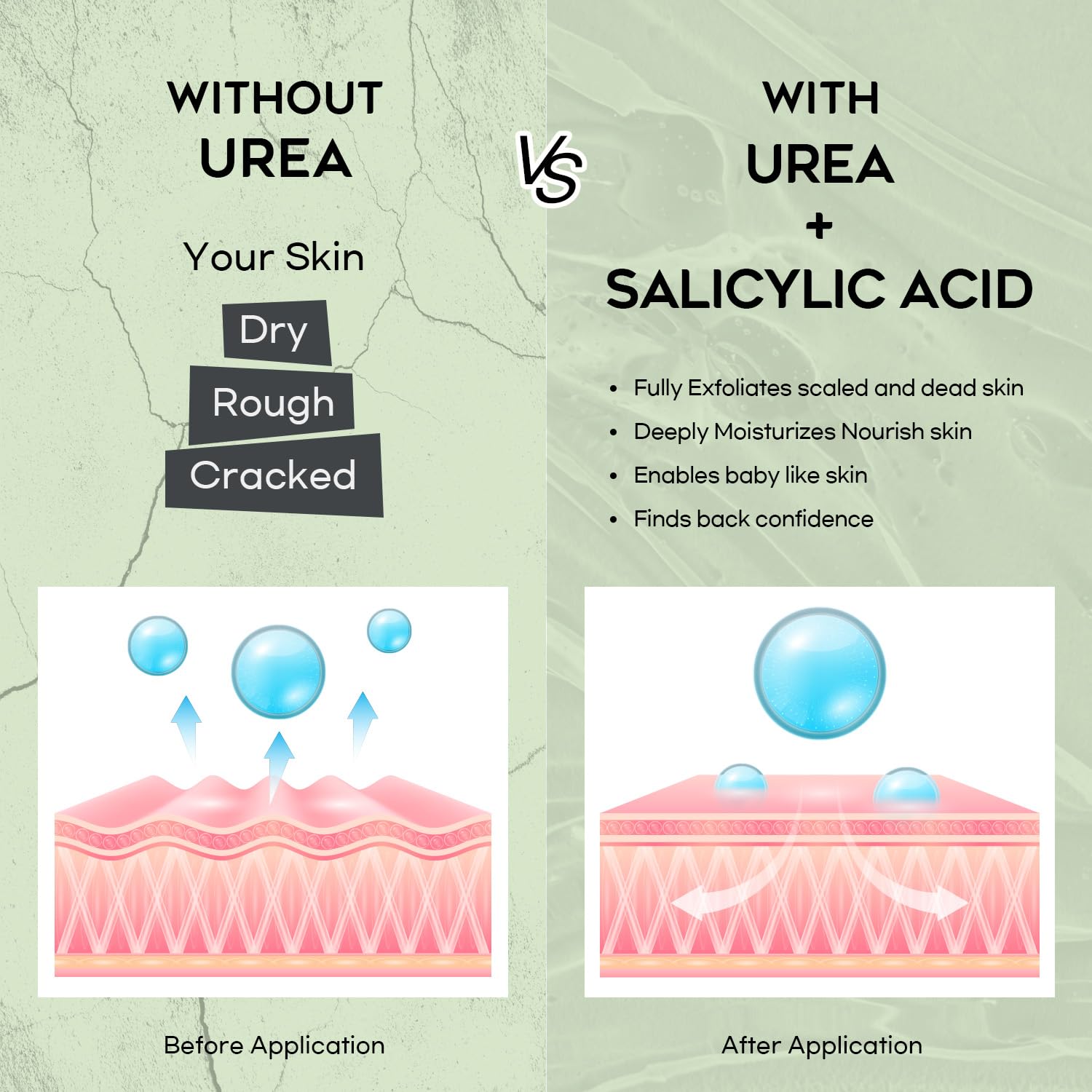 Vebuni Urea Cream texture close-up reveals rich, non-greasy feel.