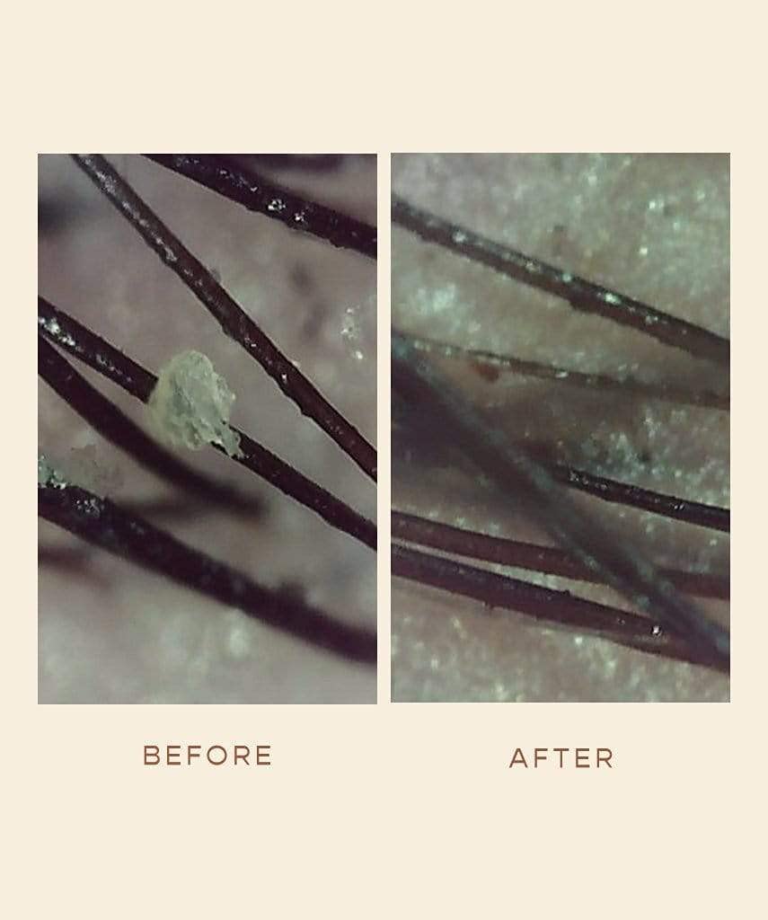VEGAMOUR GRO Detoxifying Serum citrus scent evokes refreshing spa-like ritual