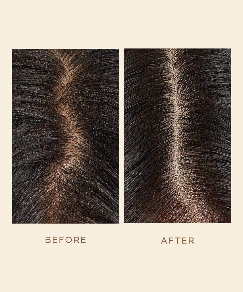 VEGAMOUR GRO Detoxifying Serum zinc PCA close-up highlights oil balance benefit