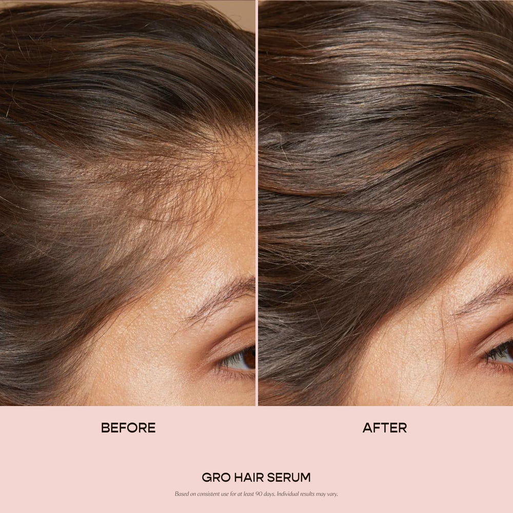 VEGAMOUR GRO Hair Serum dropper applying on scalp for soothing daily routine.