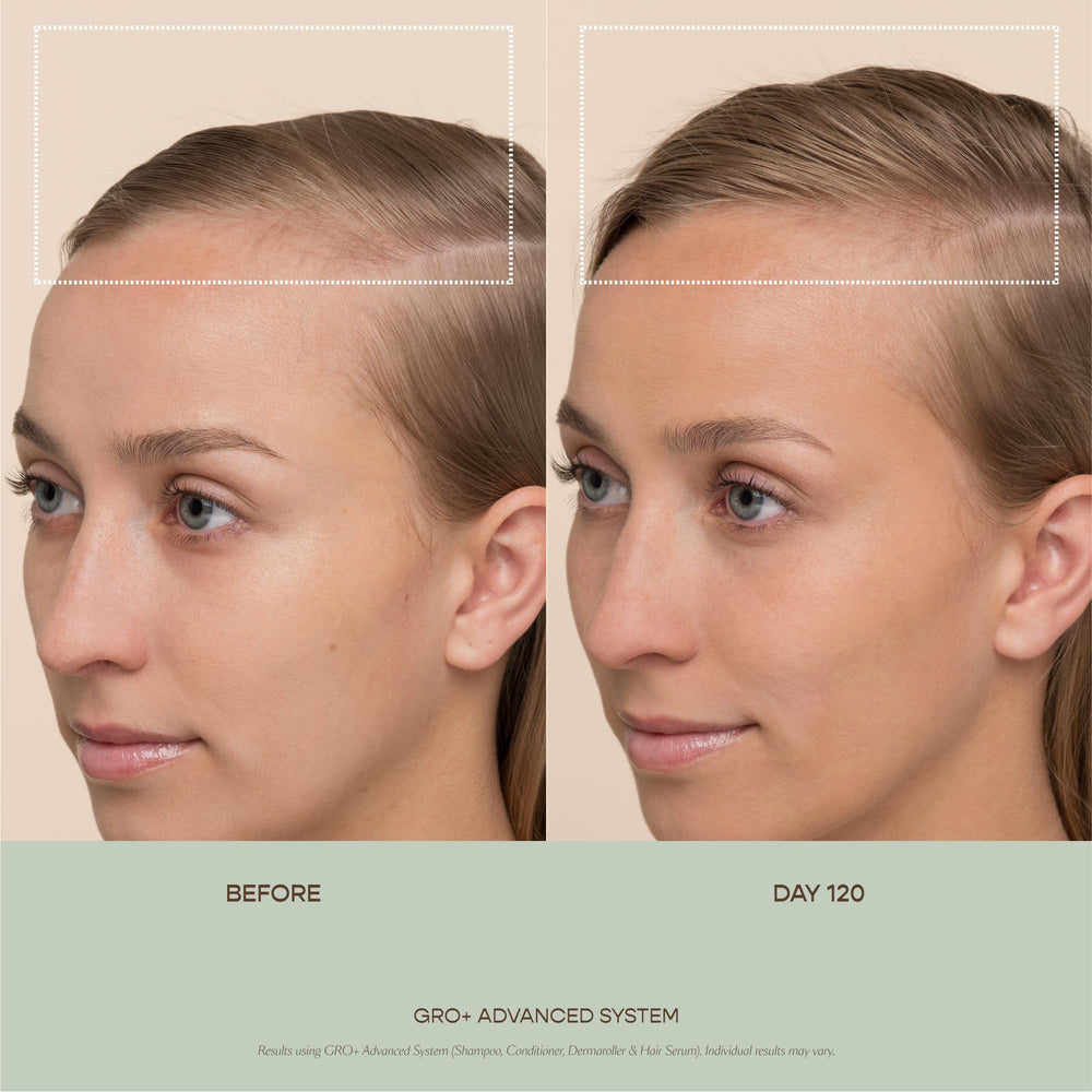 VEGAMOUR GRO+ 0.25mm needles detail shows precise exfoliation for better absorption.