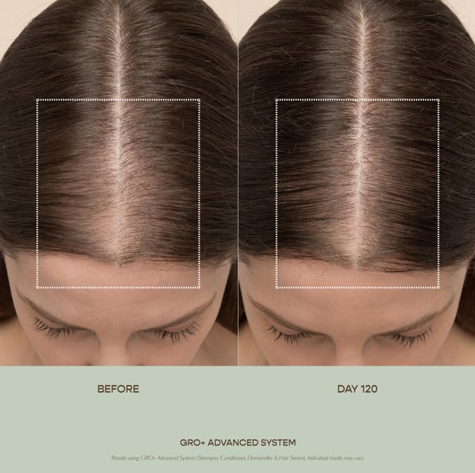 VEGAMOUR GRO+ serum applied to scalp for hydration and comfort.