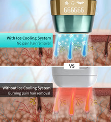 Velvvibe hair-removal-device handheld use for precise at-home sessions.