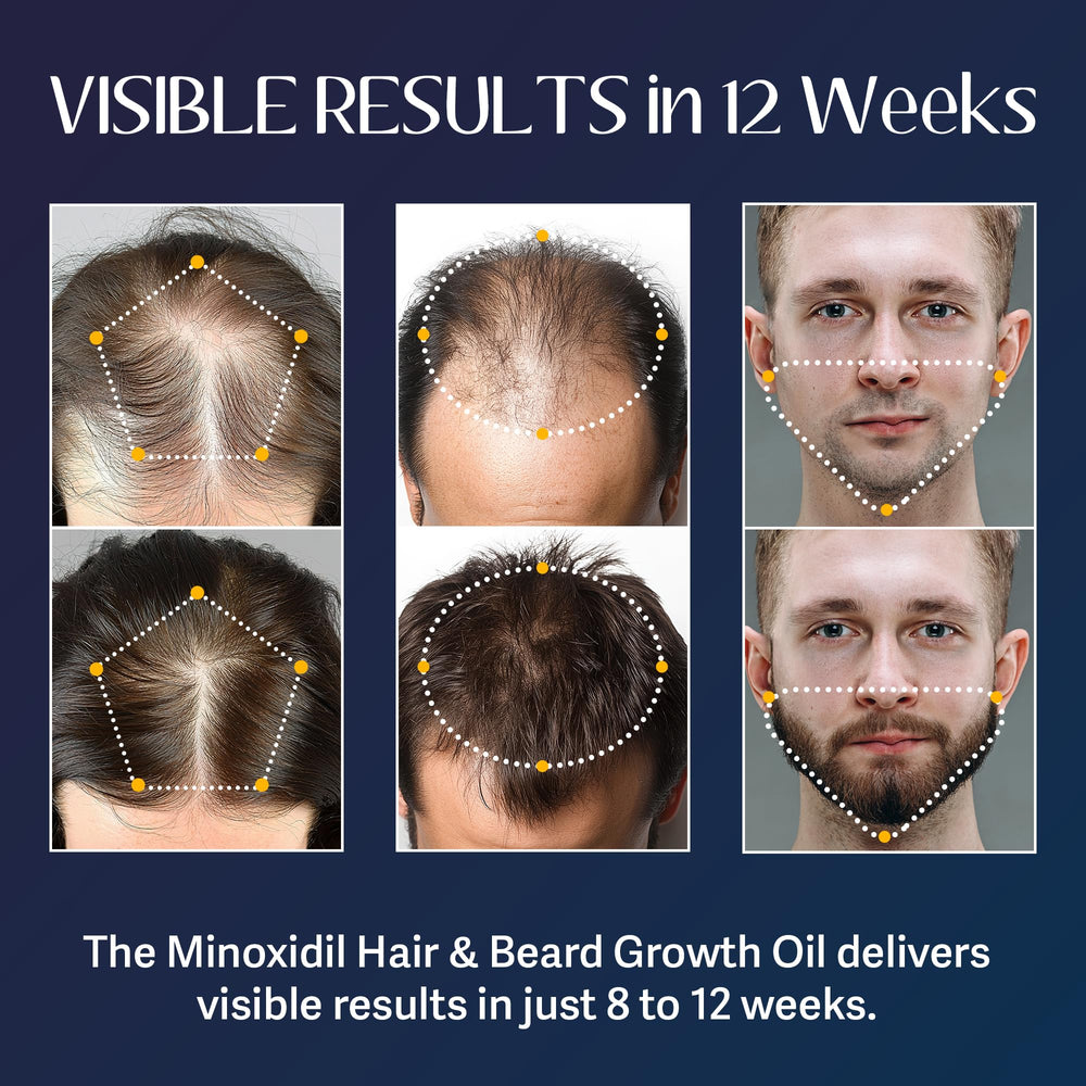 Venanoci beard growth oil dropper enables easy daily application for a fuller-looking beard.
