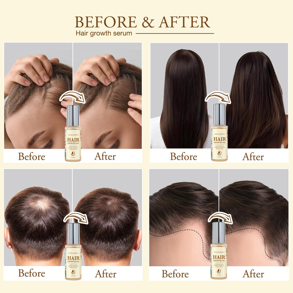 Venanoci Hair Growth Oil applied to scalp for daily nourishment and growth support