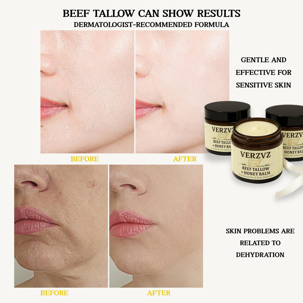 VERZVZ 2oz-honey-balm-packaging displays compact, travel-friendly moisturizer for on-the-go use.