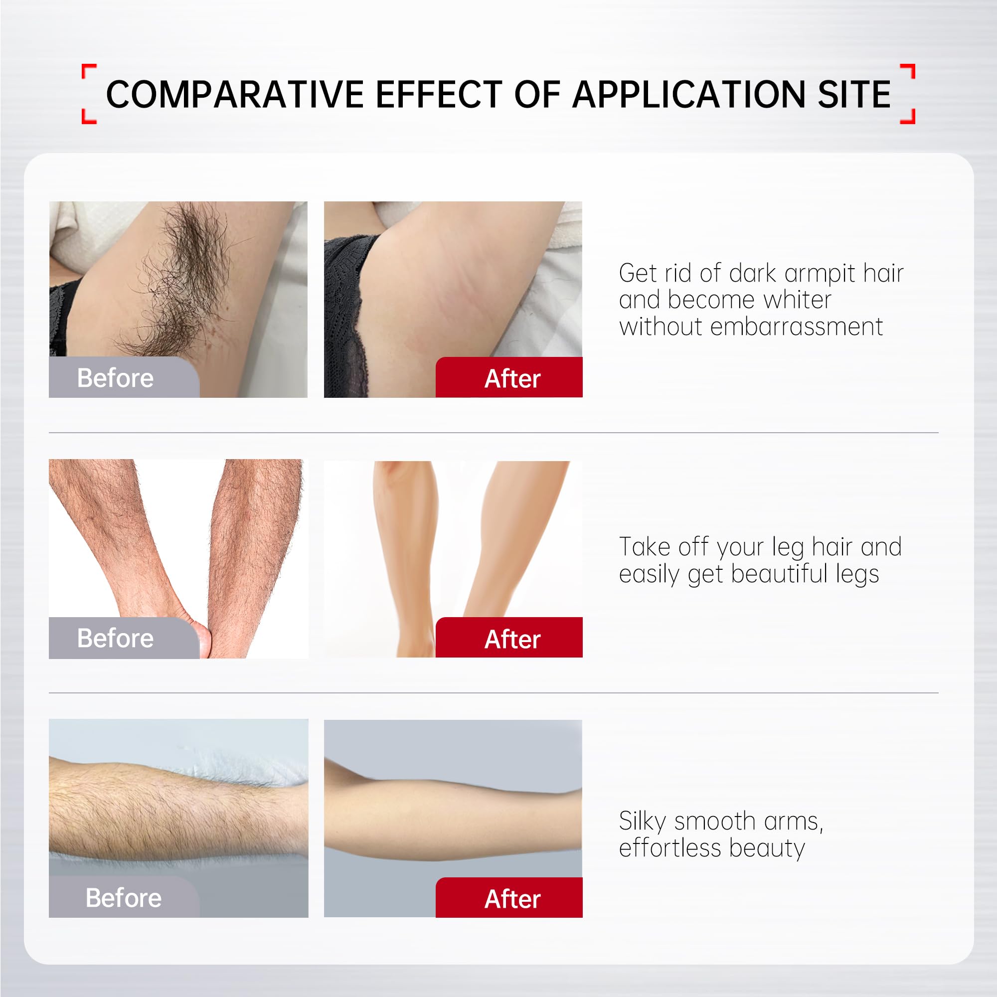 VGO body application on back and legs for efficient depilation