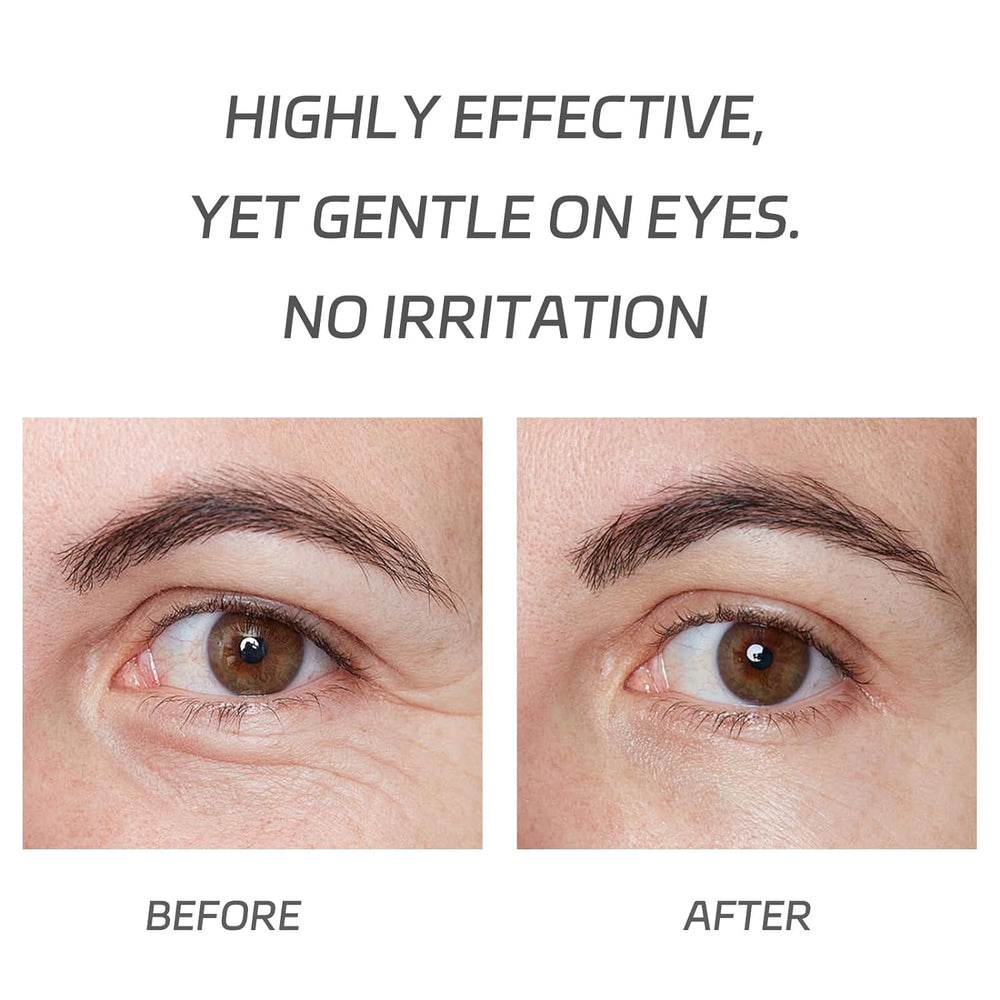 VGO Eye Cream bottle with pump cap for easy daily application.