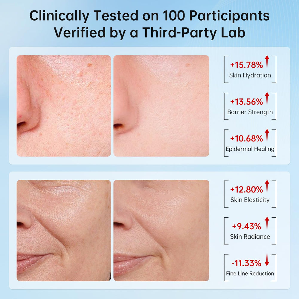 VGO Snail Mucin 92% daily-use image demonstrates simple application in routine