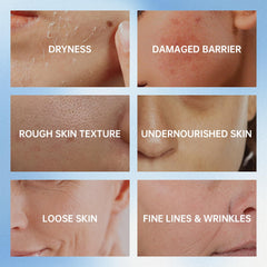 VGO snail mucin moisturizer ceramide cholesterol—skin barrier support in a lightweight cream.