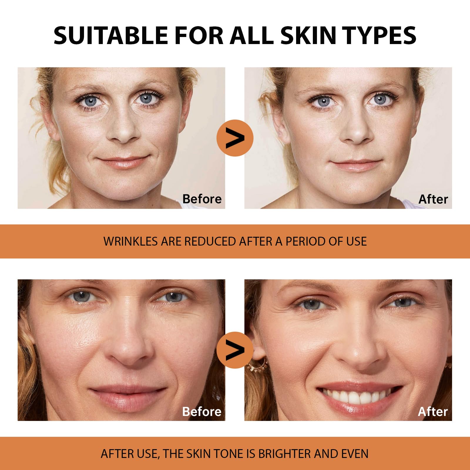 VGO Vitamin C Serum is suitable for all skin types, including sensitive skin.