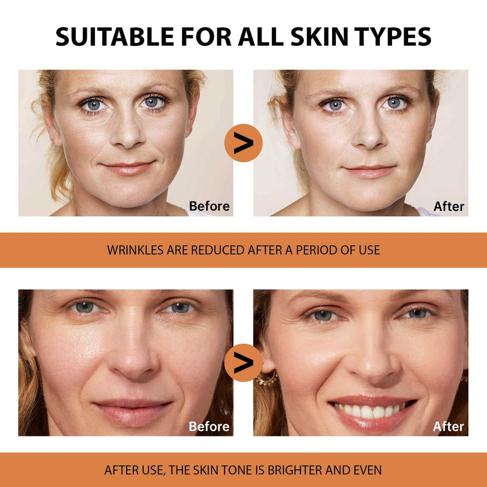 VGO Vitamin C Serum is suitable for all skin types, including sensitive skin.