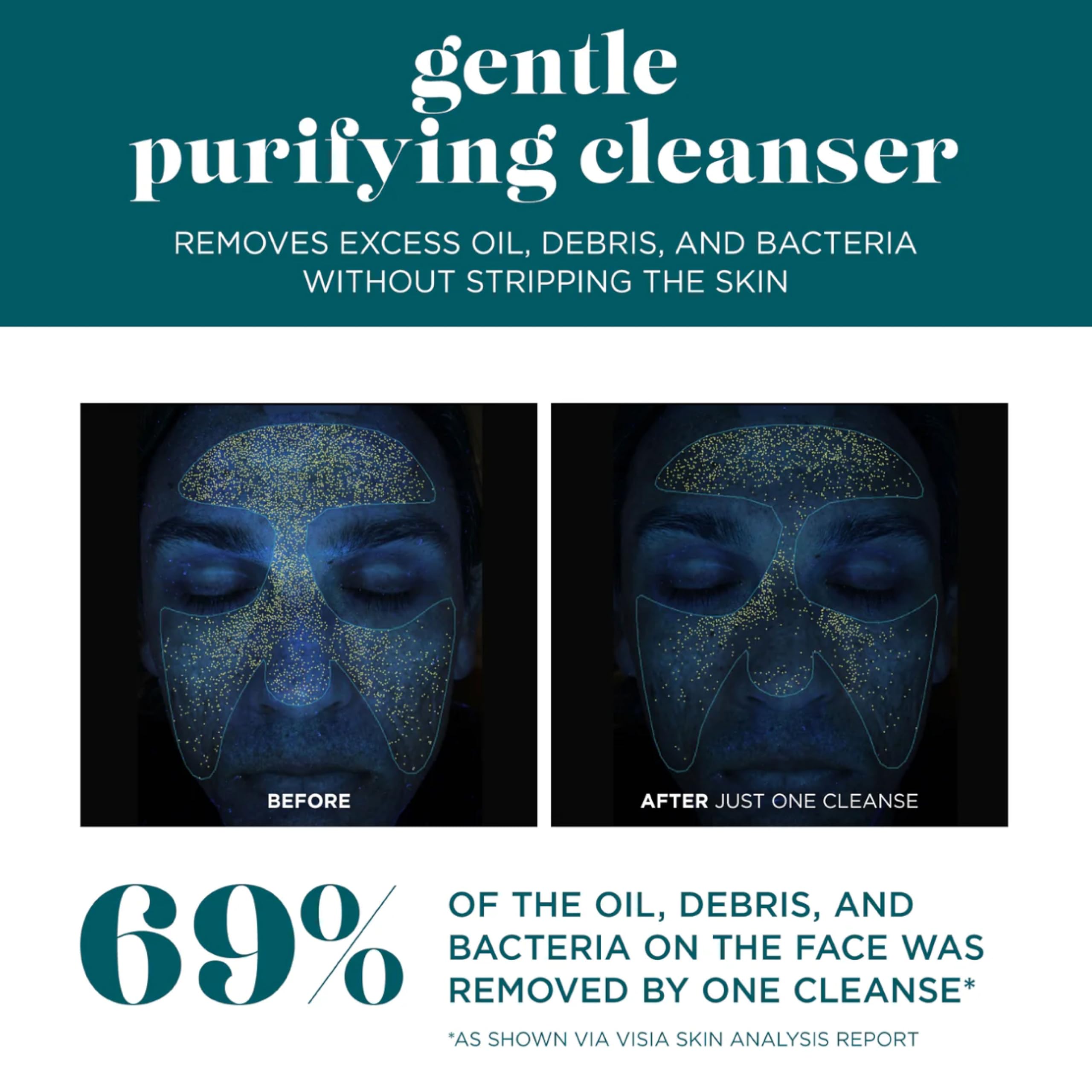 VI DERM Gentle Purifying Cleanser label close-up, fragrance-free formula ideal for sensitive skin routines.