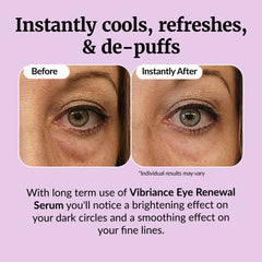 Vibriance Eye Renewal Serum designed for mature skin around the eyes and brow bone