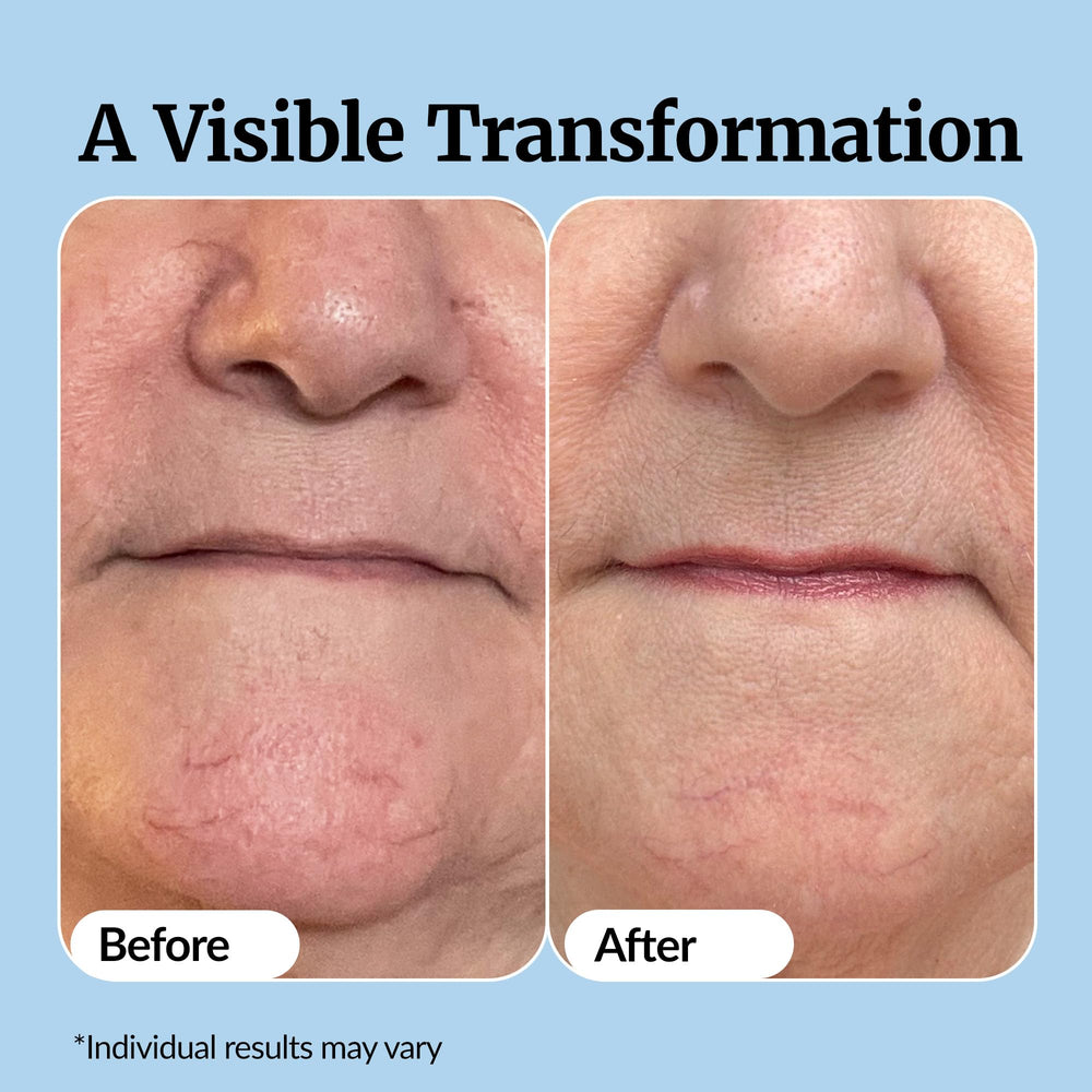 Vibriance Super C Serum packaging communicates premium quality and value