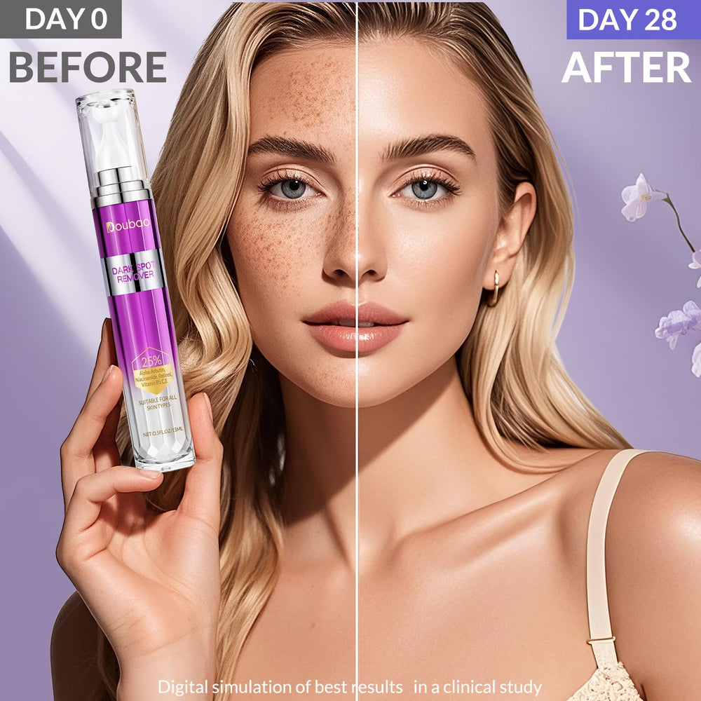 VicGFHS Dark Spot Remover neck area ready for an even-toned look on exposed skin.