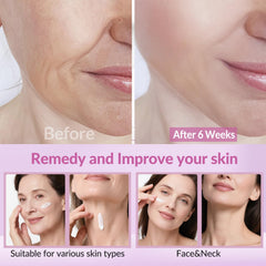 VicGFHS neck application image showing smooth, quick-absorption formula
