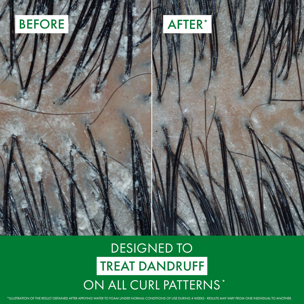 VICHY Dercos shampoo texture close-up highlighting gentle, hydrating consistency