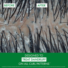 VICHY Dercos shampoo texture close-up highlighting gentle, hydrating consistency