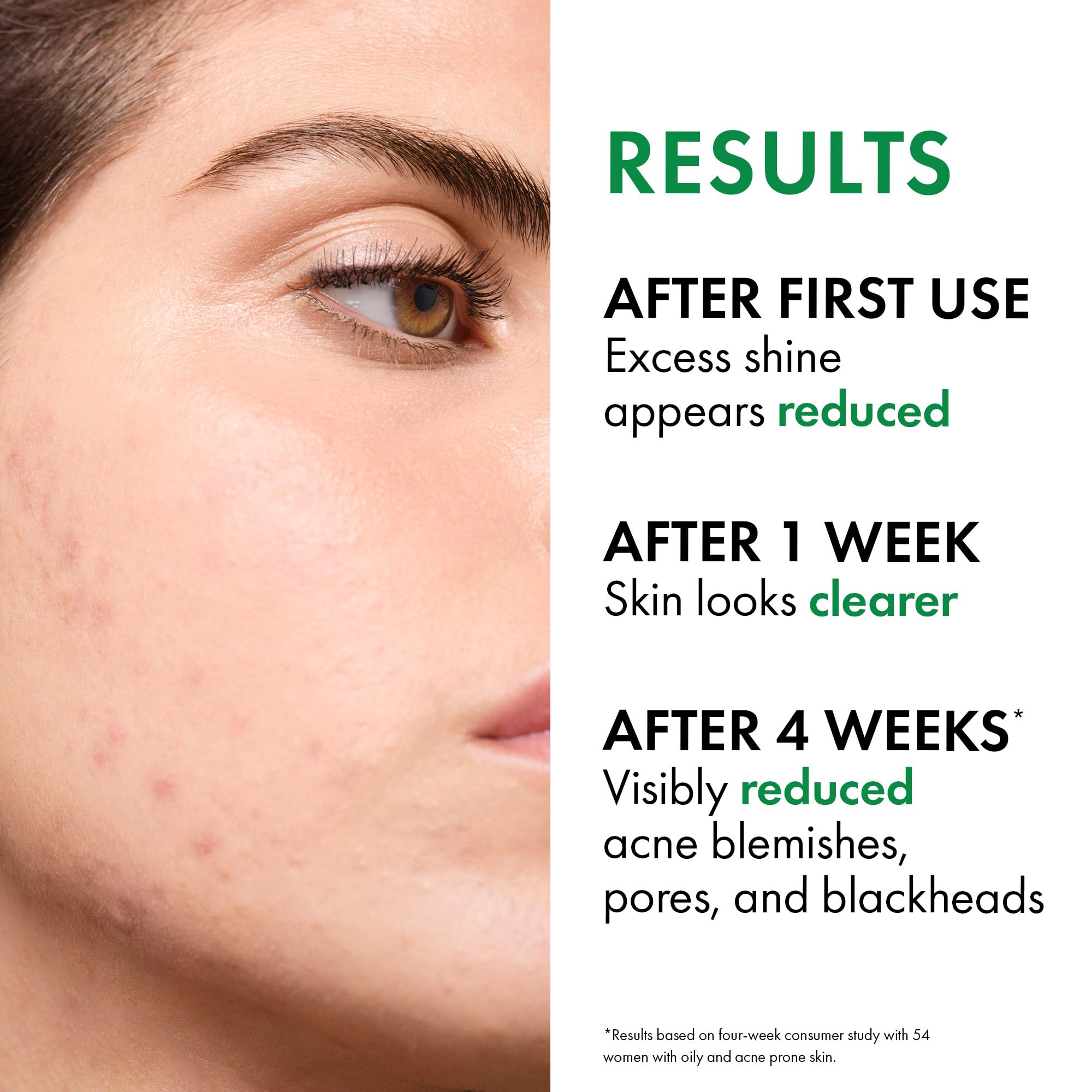 VICHY Normaderm foamy lather on skin for effective oil removal