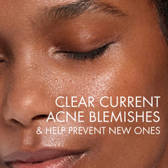 VICHY Normaderm gel texture close-up showing lightweight foaming action