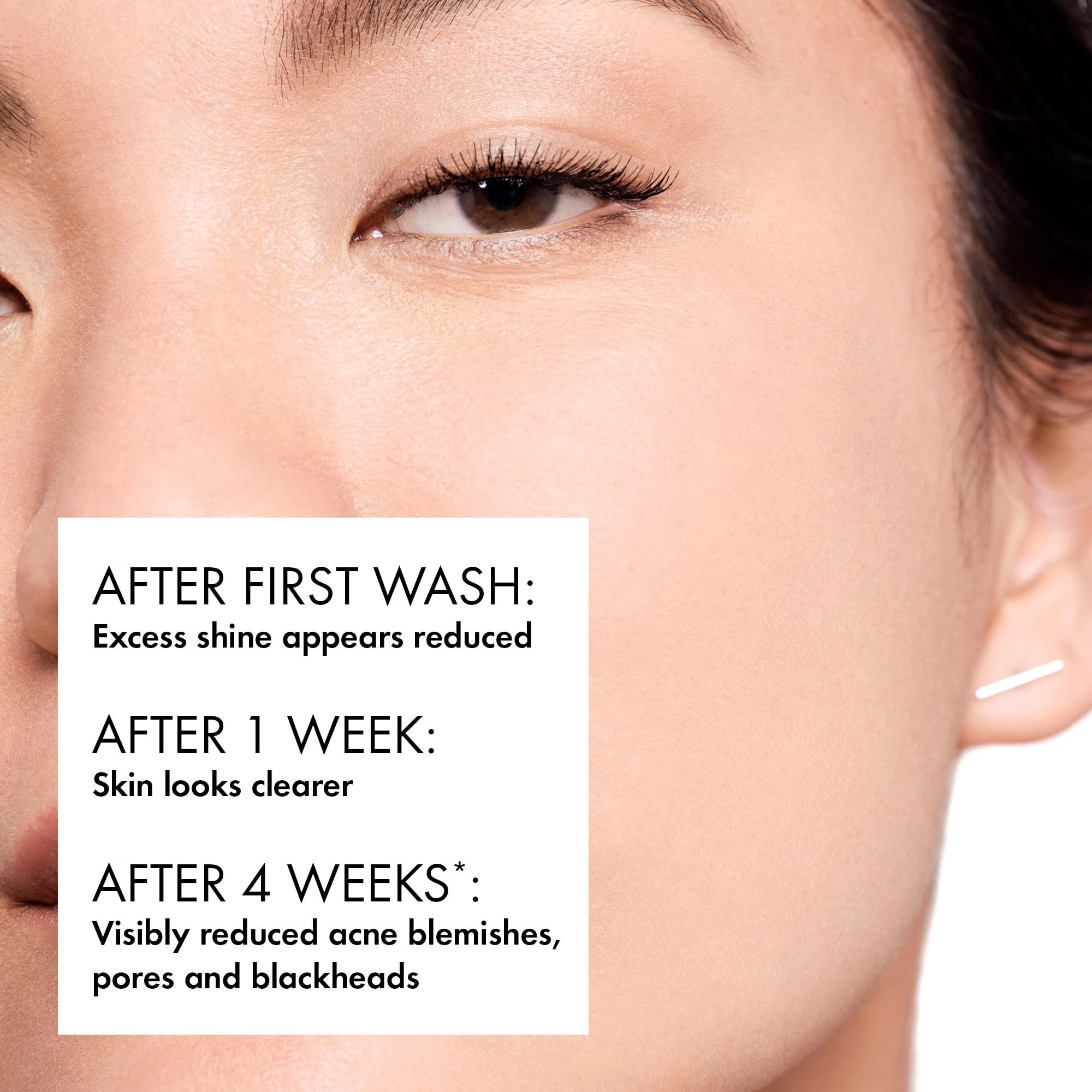 VICHY Normaderm with volcanic water visual highlighting mineral benefits