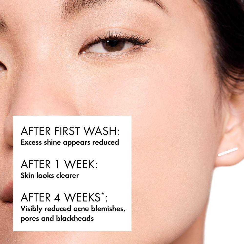 VICHY Normaderm with volcanic water visual highlighting mineral benefits