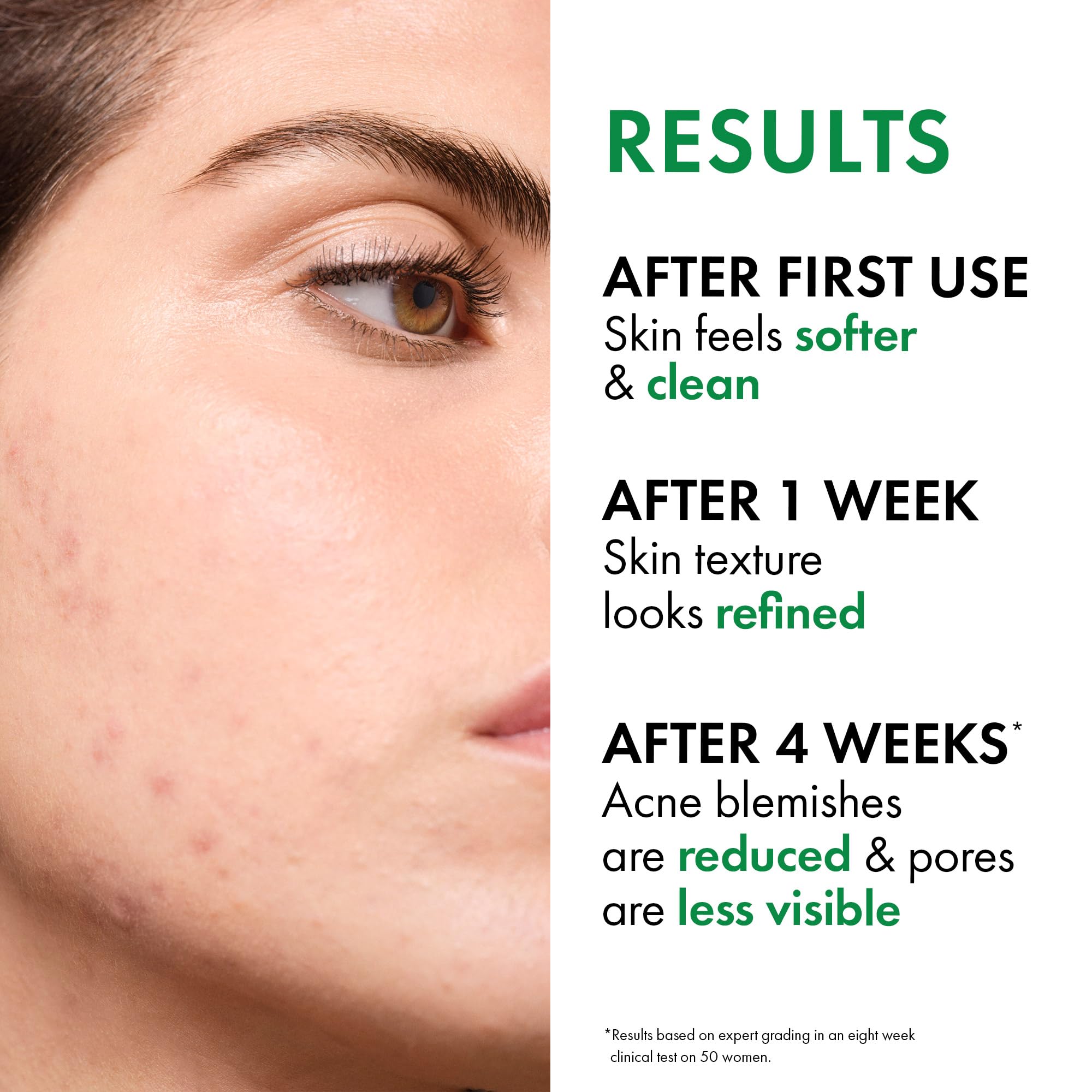 VICHY salicylic acid ingredient graphic for targeted exfoliation