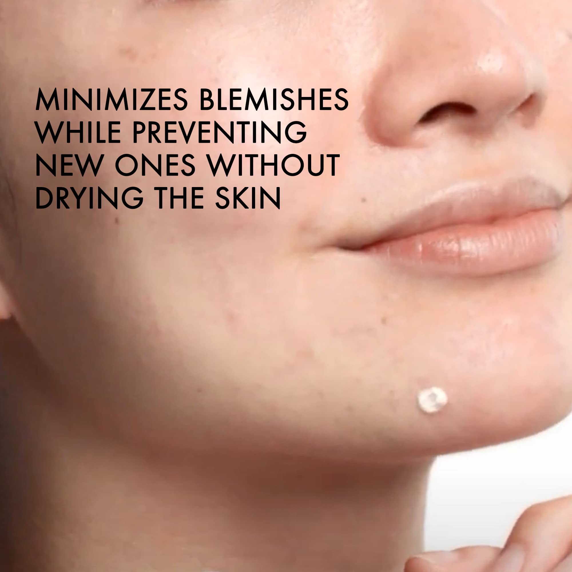 Vichy Normaderm tube and cap detail highlighting precision applicator benefit
