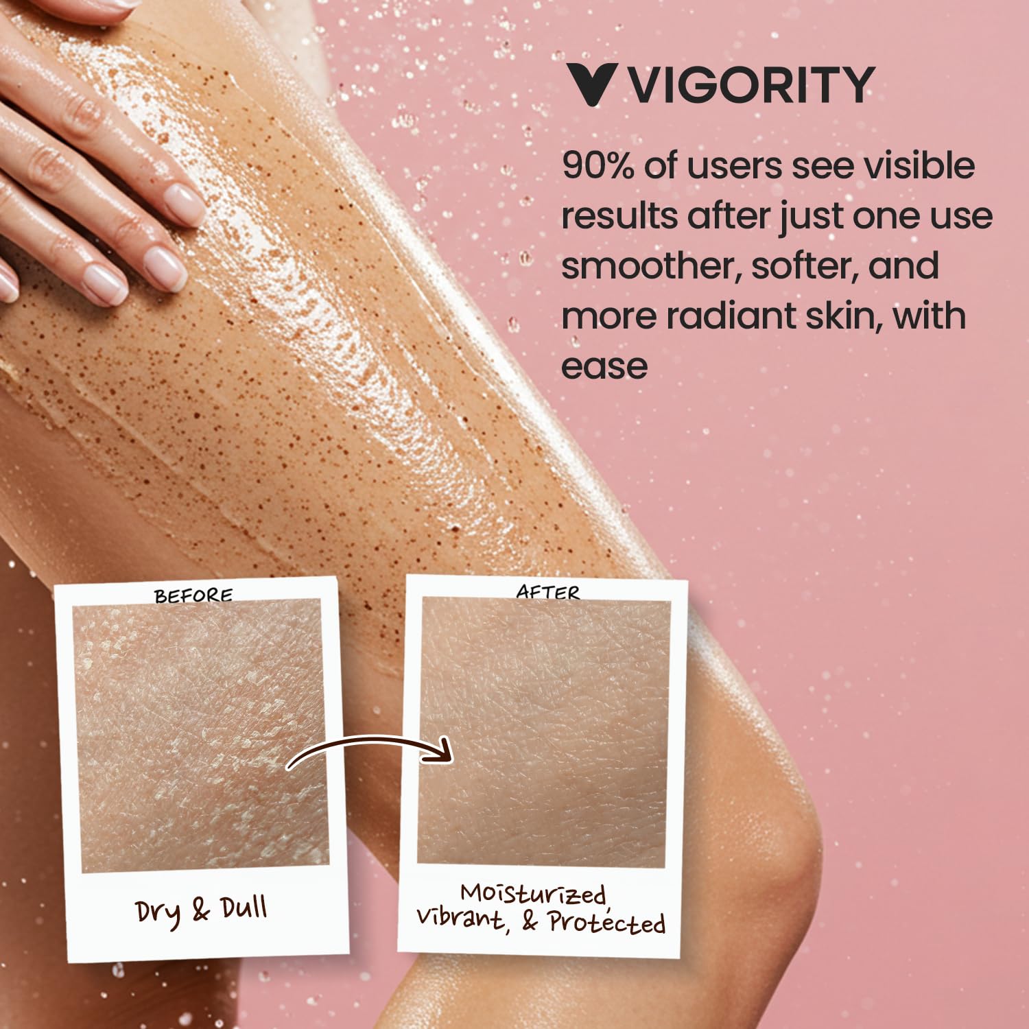 Glycolic and lactic acids in Vigority KP Bump Eraser cleanse pores and renew skin surface