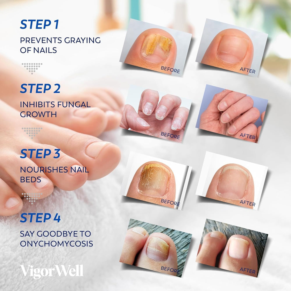 VigorWell overnight action nail patches image shows eight hour wear for nightly use