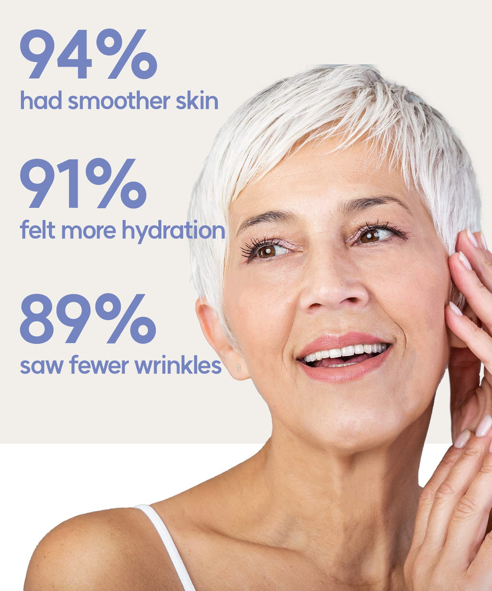 Vilvin dissolving microdart patches on mouth lines suggesting potential smile-line smoothing after use