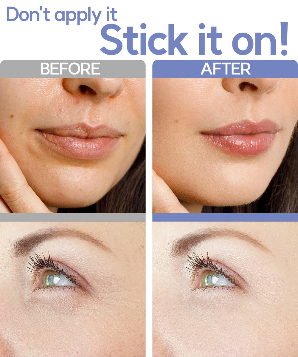 Vilvin dissolving microdart patches applied under-eye area for hydration and smoothing