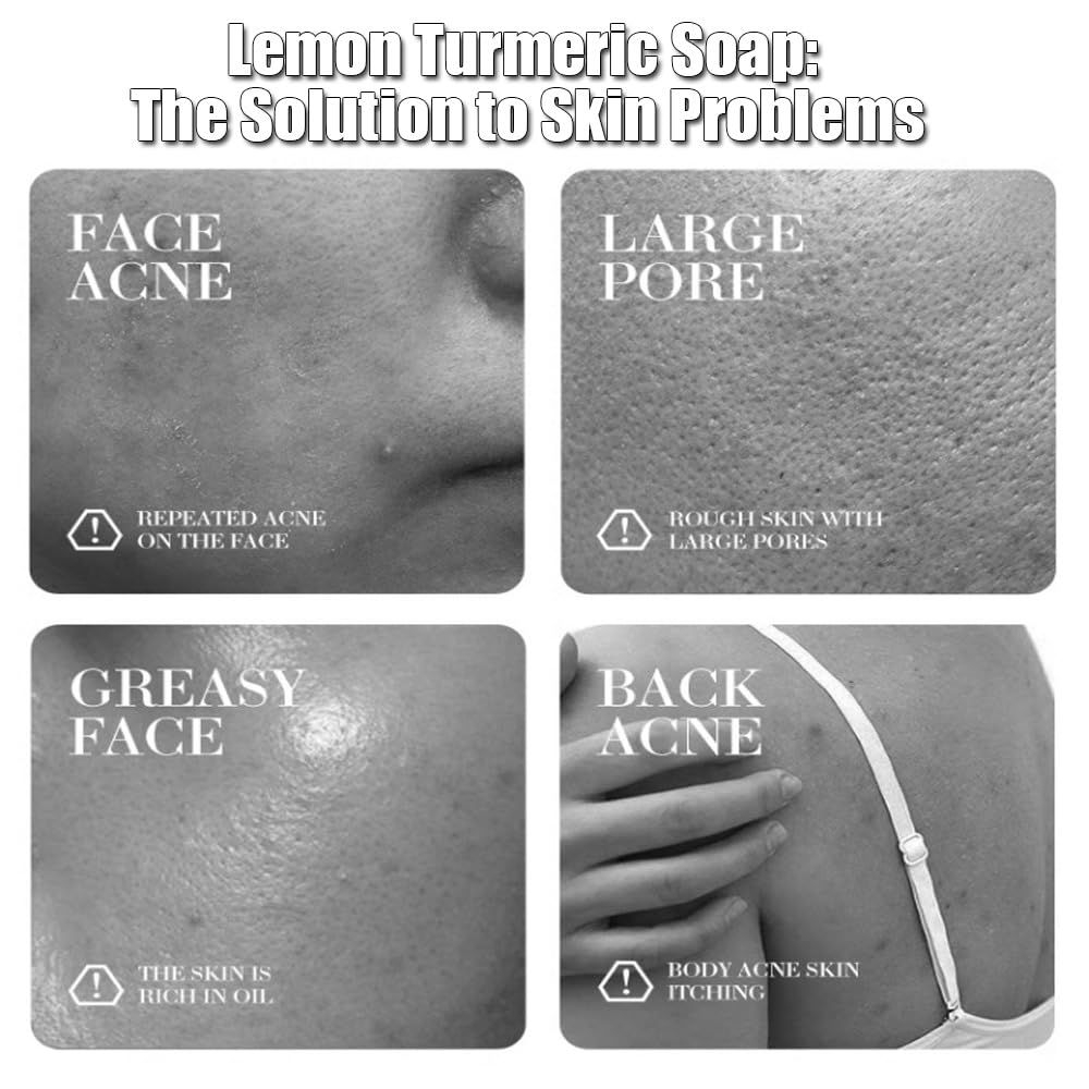 Vingtank daily-use turmeric and kojic routine for clearer-looking skin