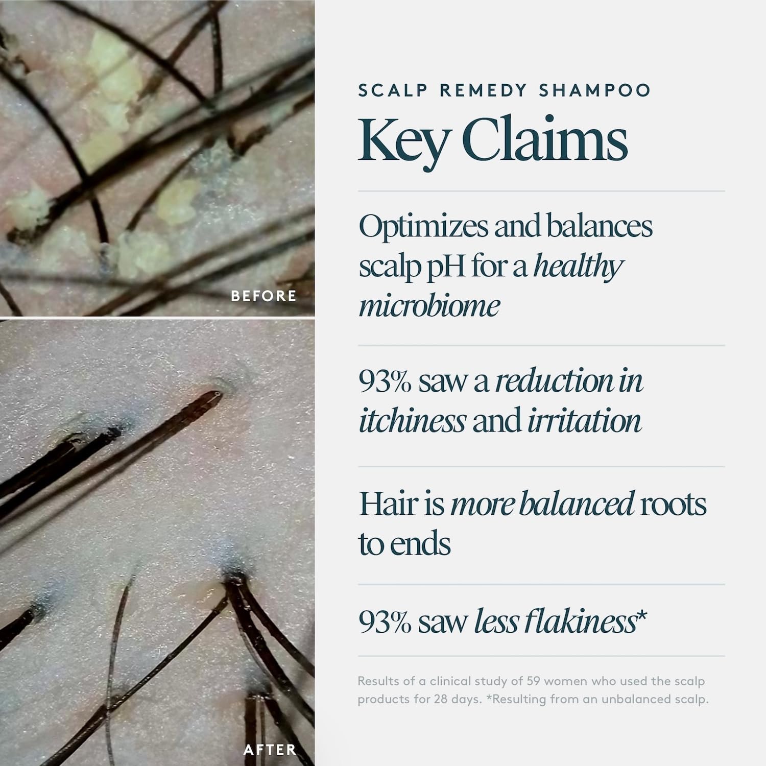 VIRTUE Scalp Remedy Close-Up Keratin highlights hair-strengthening properties.