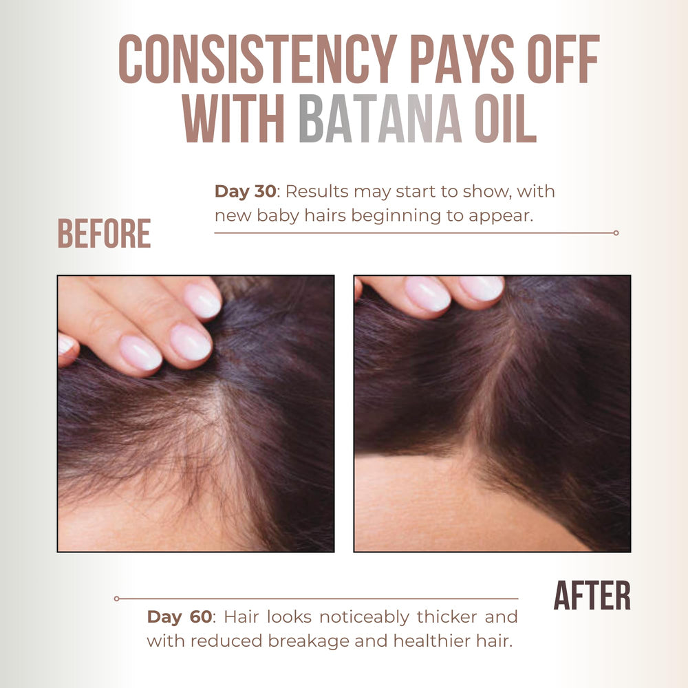 Vitamo Batana Oil rich in fatty acids for deep hydration.