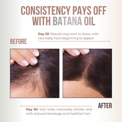 Vitamo Batana Oil rich in fatty acids for deep hydration.
