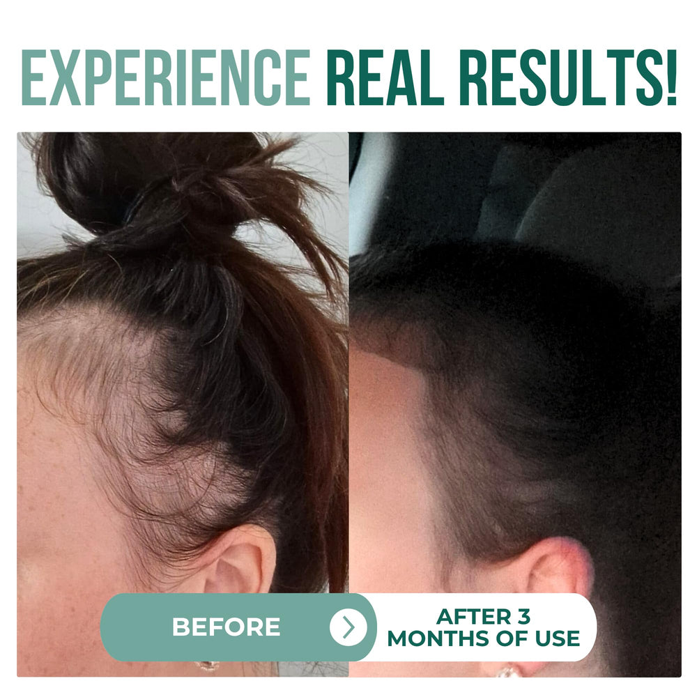 Vitamo Batana oil scalp treatment close-up demonstrates rejuvenating care.