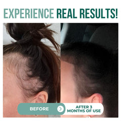 Vitamo Batana oil scalp treatment close-up demonstrates rejuvenating care.